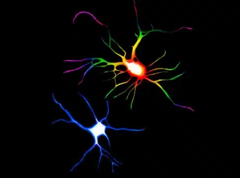 dendritic spines
