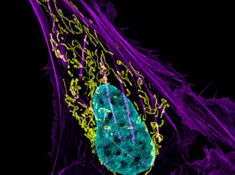 osteocarcinoma cell