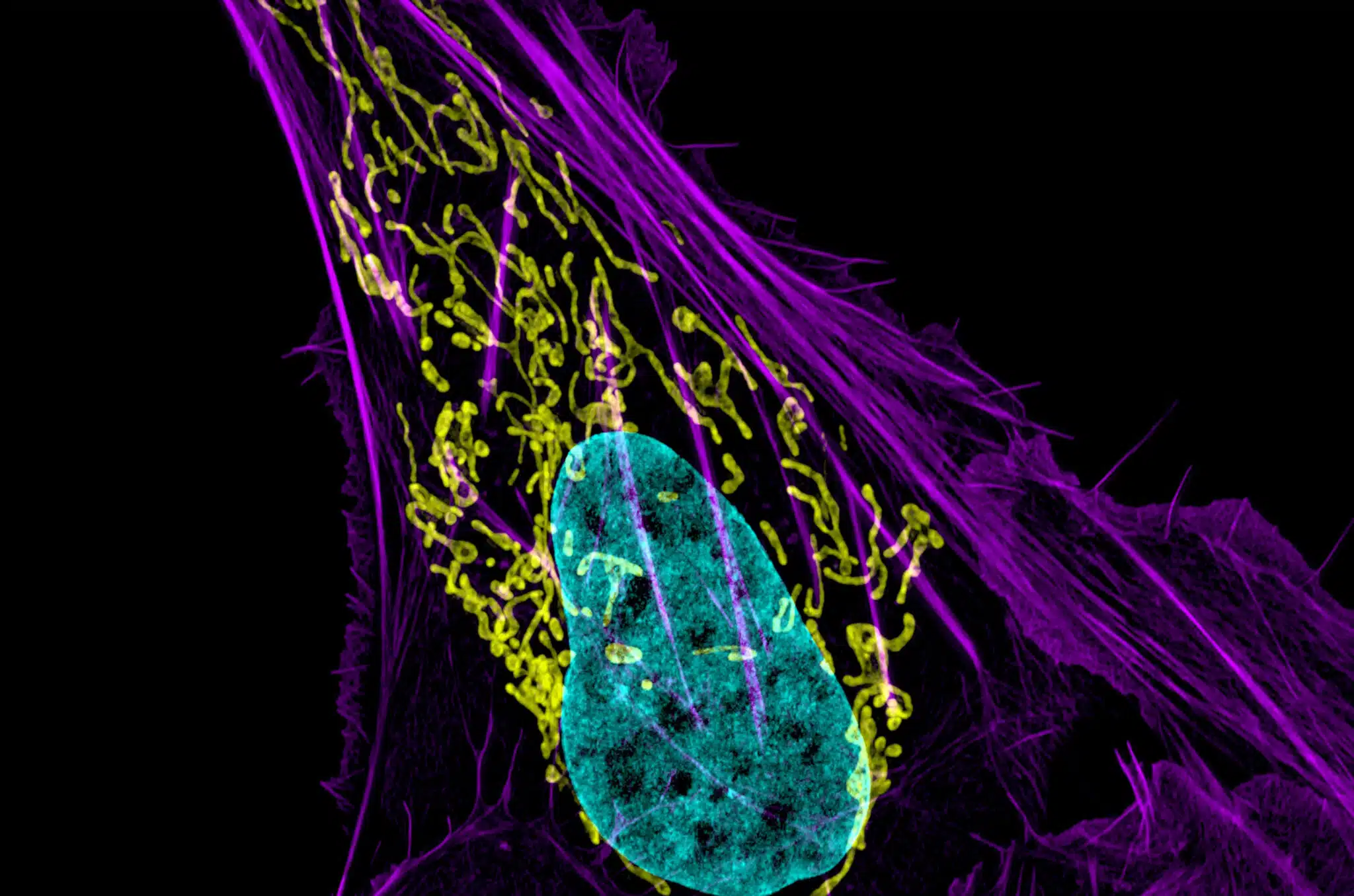 osteocarcinoma cell
