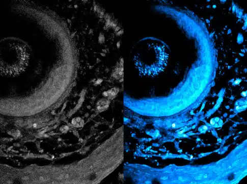 noninvasive-imaging-method