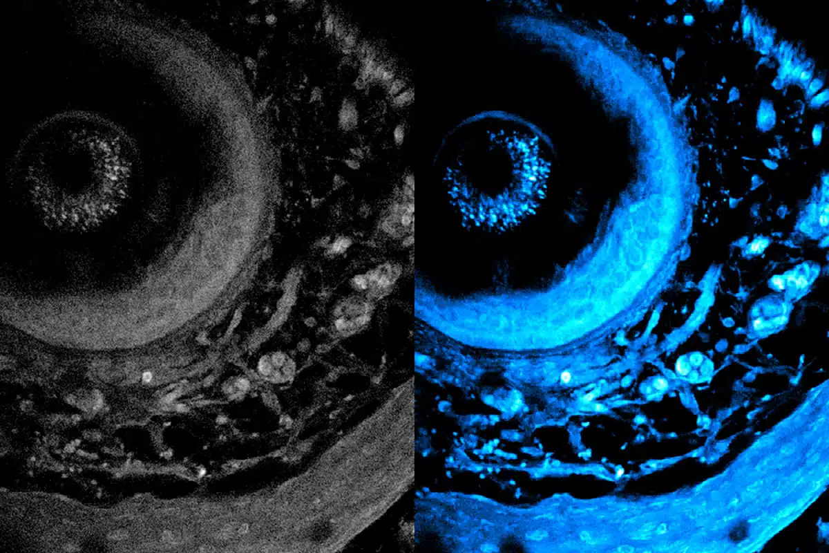noninvasive-imaging-method