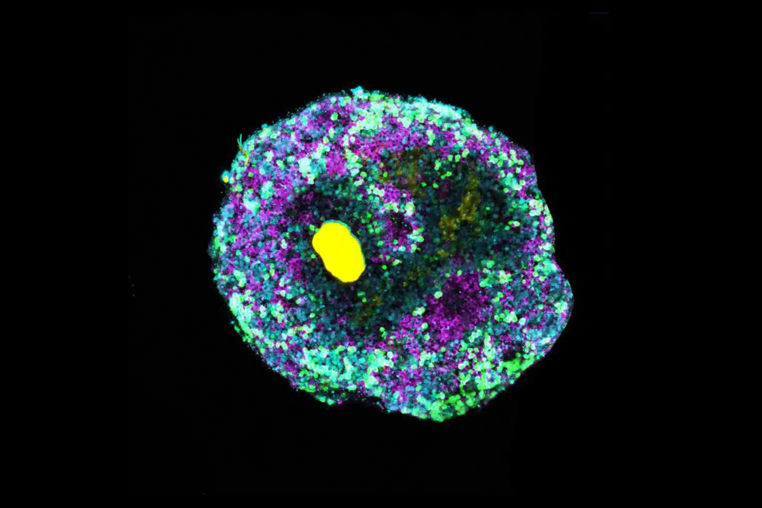 Retinal organoid with a microscopically small bead of DNA